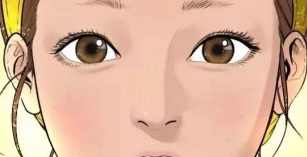 重睑手术可以改善单眼皮、肿泡眼吗？多少钱|恢复期|提升眼部|双眼皮修复|医生